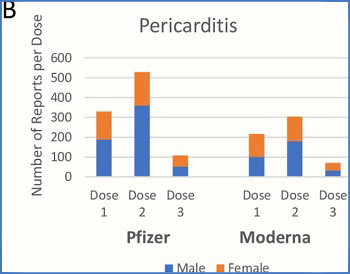 Pericarditis